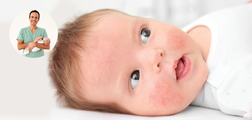 Baby with eczema on cheeks next to paediatrician Dr Golly